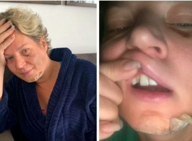 Deputada acorda com diversas fraturas e sugere ter sido vítima de atentado