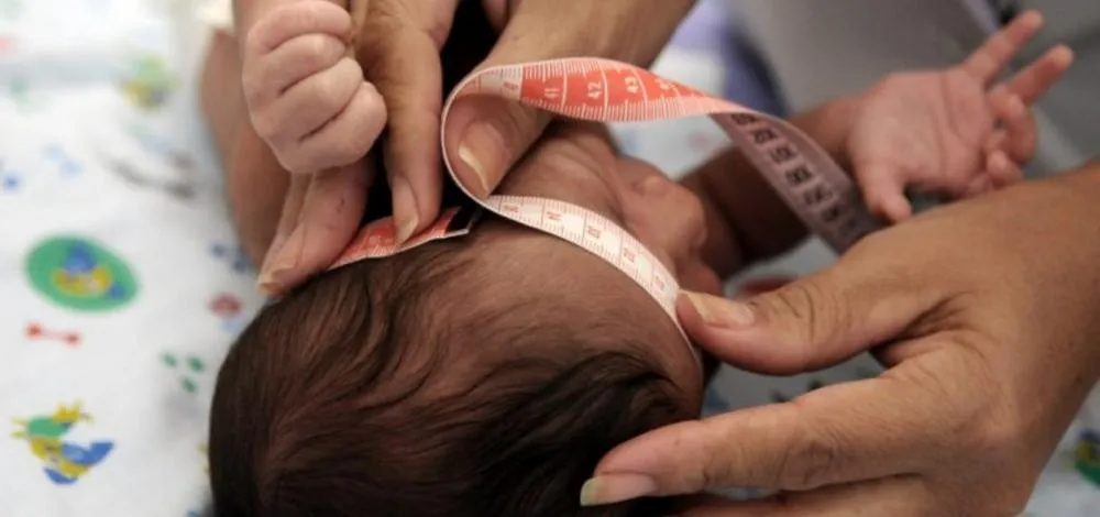 Crianças com síndrome congênita do Zika terão indenização e pensão vitalícia