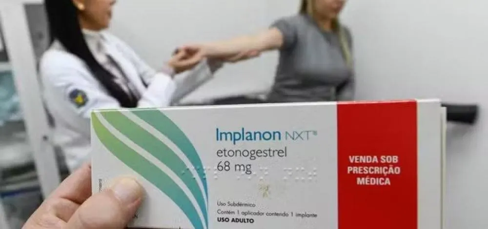 Ministério da Saúde recebe primeiras unidades de implante contraceptivo para o SUS