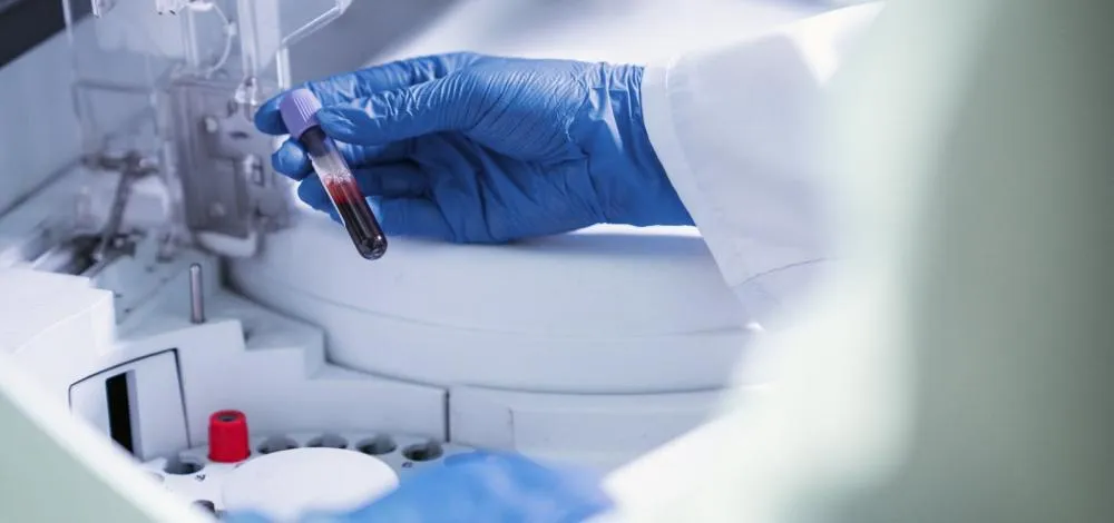 Exame de sangue para detectar Alzheimer chega ao Brasil