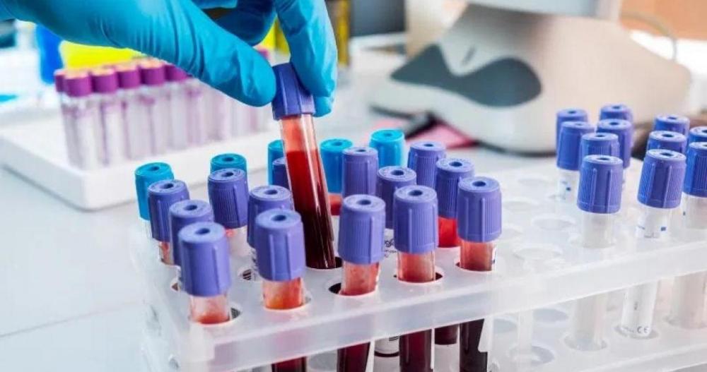 Estado bate recordes de casos ativos e de novos registros de Covid-19