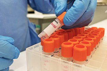 Bahia registra primeiro caso suspeito de Varíola dos Macacos