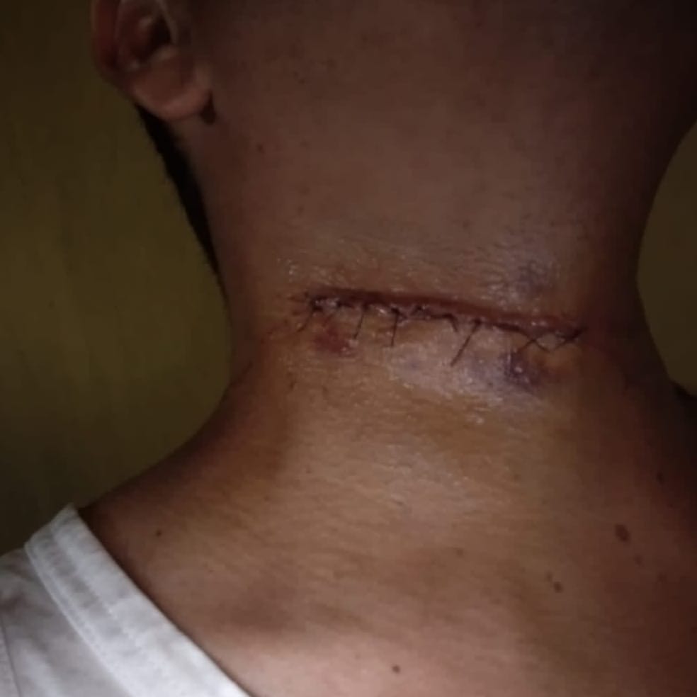 Operador de máquinas é quase degolado por linha chilena