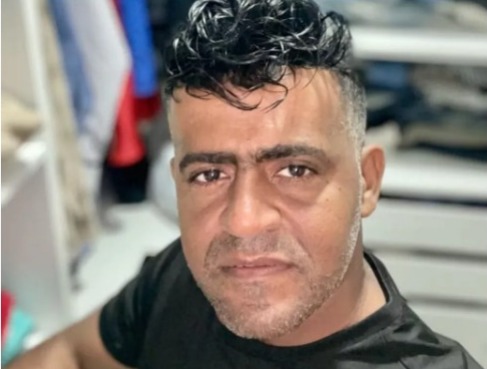 Médico acusado da morte de comerciante durante implante capilar será indiciado por homicídio culposo