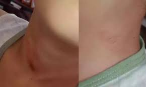 Criança de 7 anos é enforcada por PM após manifestar apoio a Lula