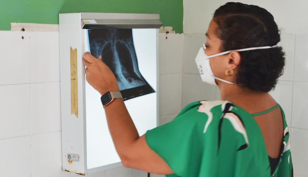 Casos de tuberculose reduzem em 34% em Feira de Santana