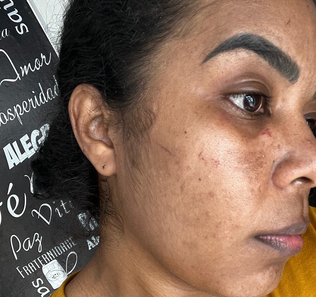 Cantora gospel acusa motorista de aplicativo por agressão física