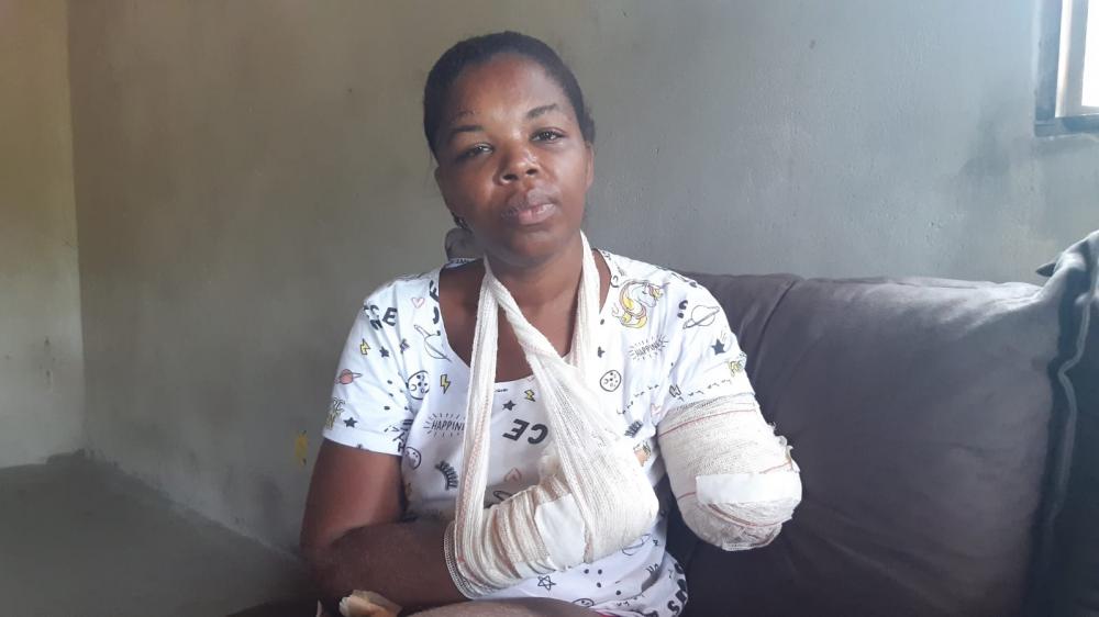 Jovem que teve braço arrancado e filha morta pelo ex-companheiro pede ajuda psicológica 