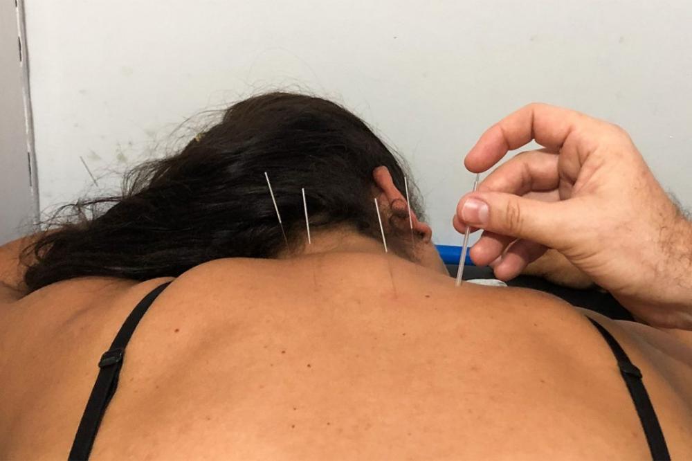 CAPS 3 amplia atendimento para terapia por acupuntura
