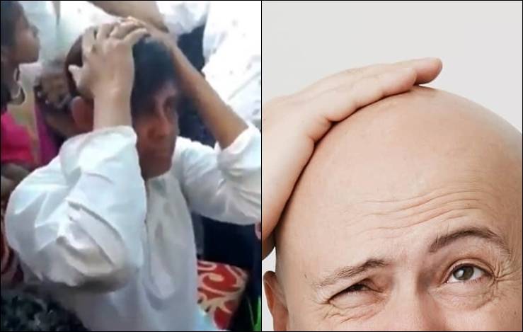 Noivo é agredido por família de esposa ao descobrirem careca