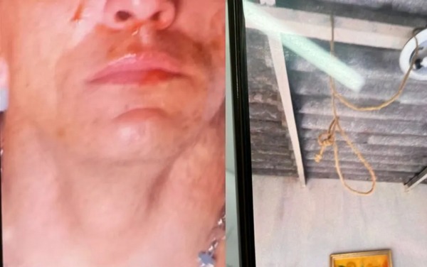 Homem denunciado por violência doméstica finge tentar se matar para comover namorada