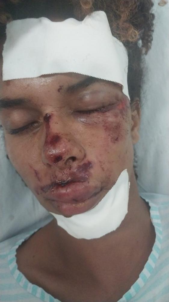 'Rosto desfigurado': influencer é espancado em assalto em Ruy Barbosa