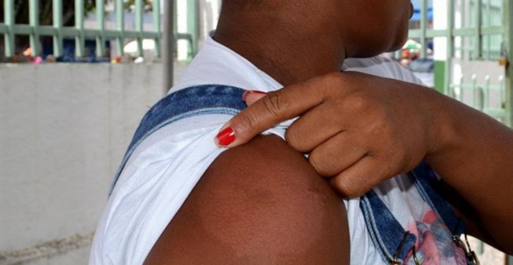 Feira de Santana e mais 114 municípios baianos receberão vacina contra dengue