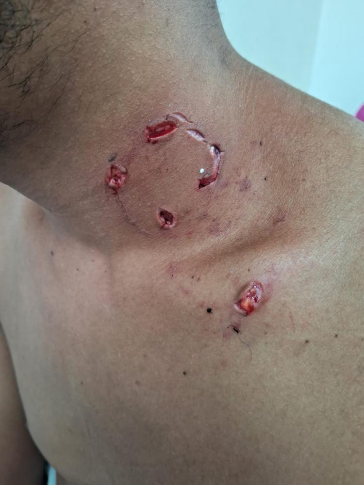 Homem é raptado e espancado no bairro Tomba.